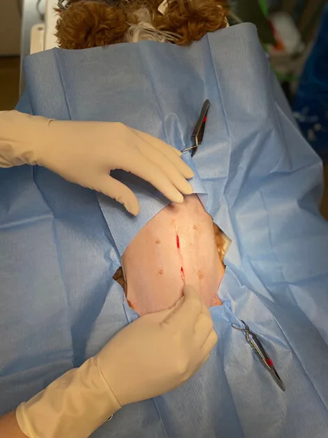 Laparoscopic Spay (Keyhole Surgery)